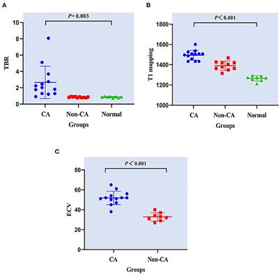 Diagnostic Value of 11C-PIB PET/MR in Cardiac Amyloidosis